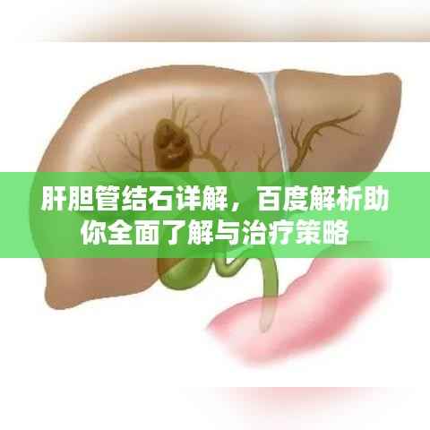 肝胆管结石详解,百度解析助你全面了解与治疗策略