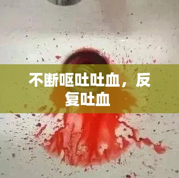 不断呕吐吐血,反复吐血
